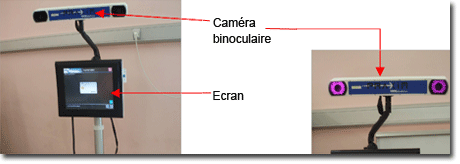 Prothèse totale de hanche