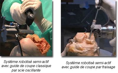 chirurgie assistée par ordinateur